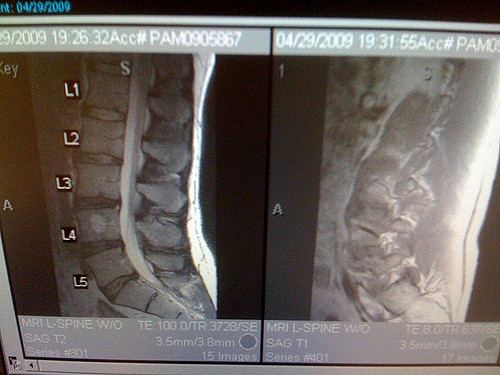 my spine, 2009